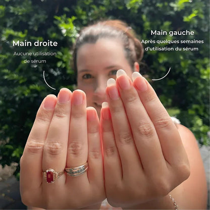 Retrouvez des ongles élégants, naturels et résistants (1 ACHETÉ = 1 OFFERT)