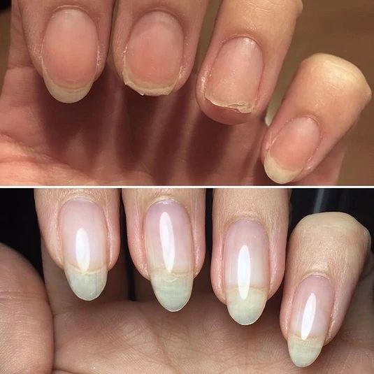 Retrouvez des ongles élégants, naturels et résistants (1 ACHETÉ = 1 OFFERT)